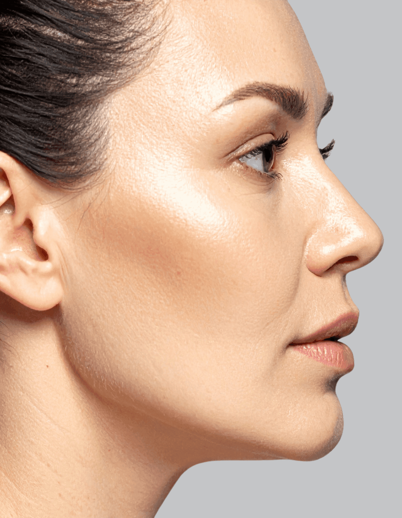 After HydraFacial® treatment