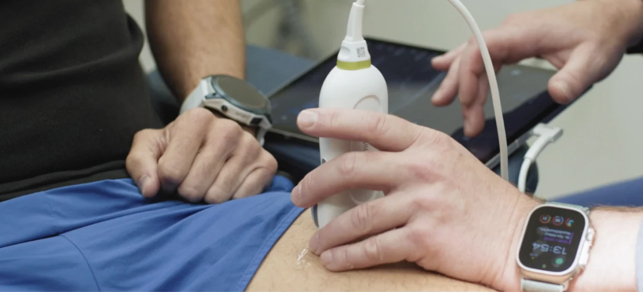 Clinician scanning a patient’s thigh with a handheld ultrasound probe