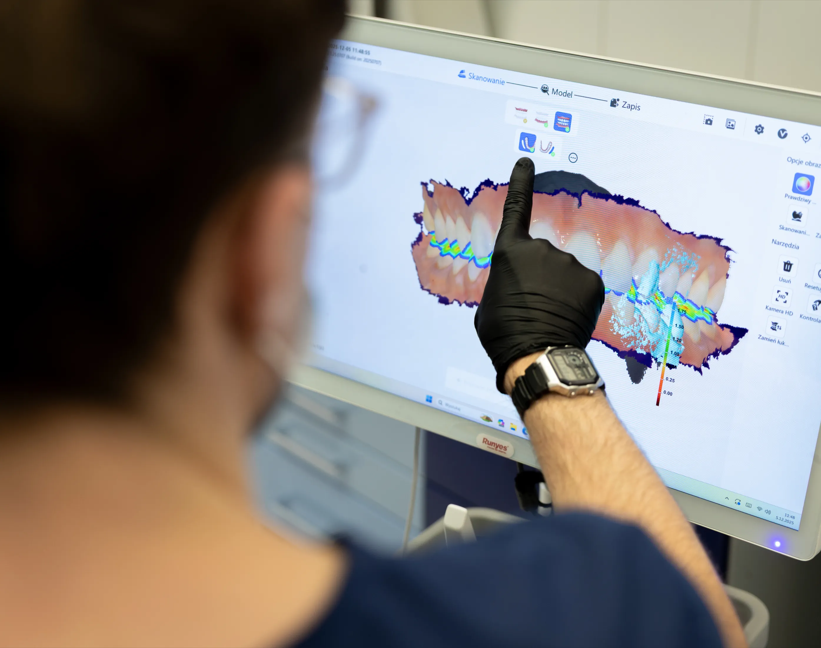 Lekarz prezentujący jak wyglądają nakładki.