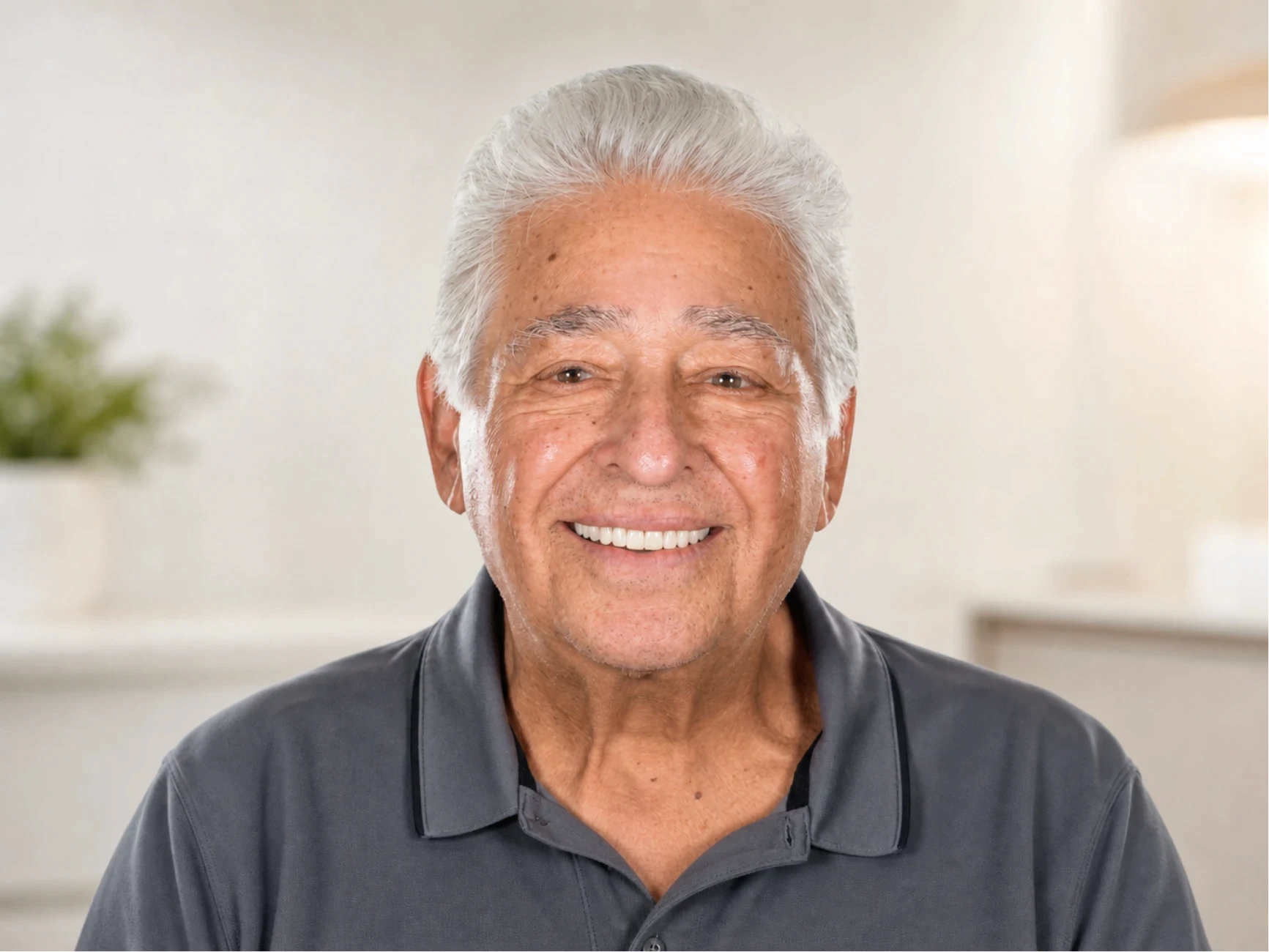 Patient 1 after full-arch dental implant treatment at lleveza