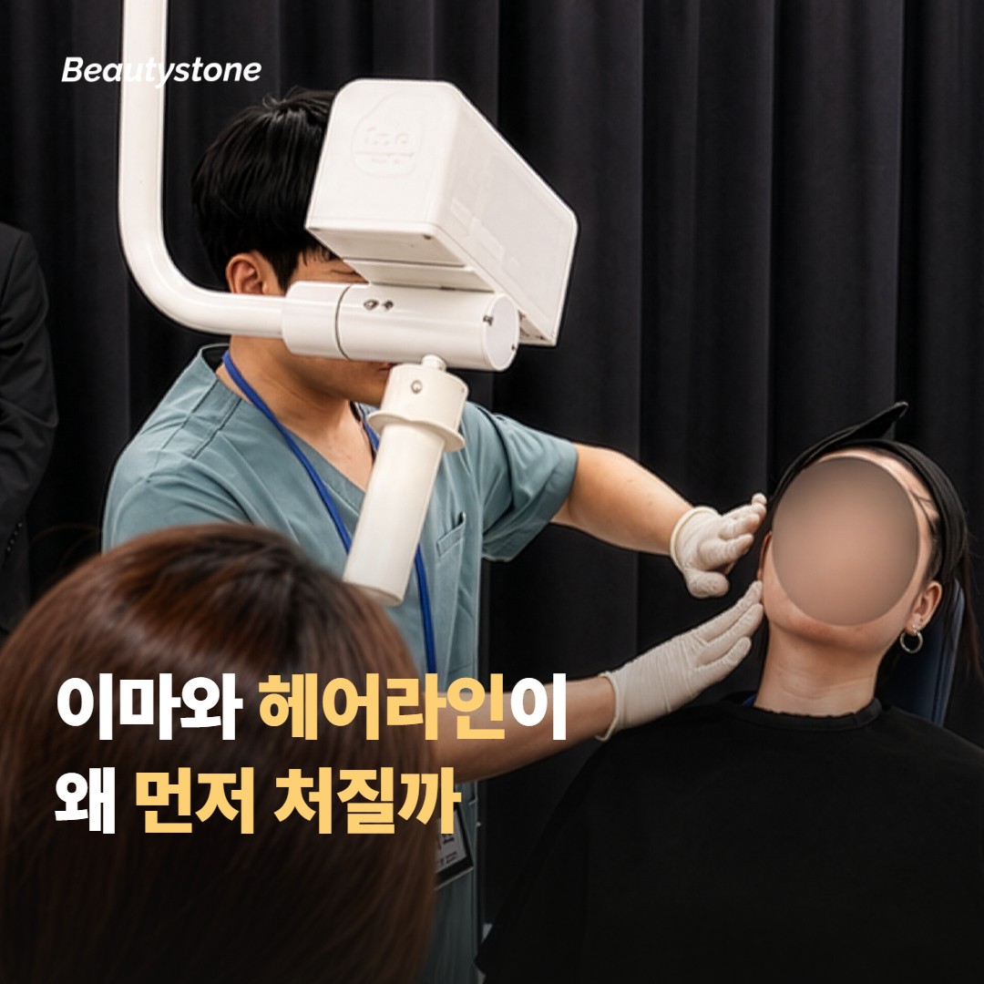 이마와 헤어라인, 왜 먼저 늘어질까요?