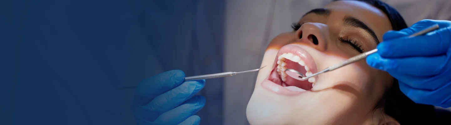 General dentistry in oral nexus, coimbatore