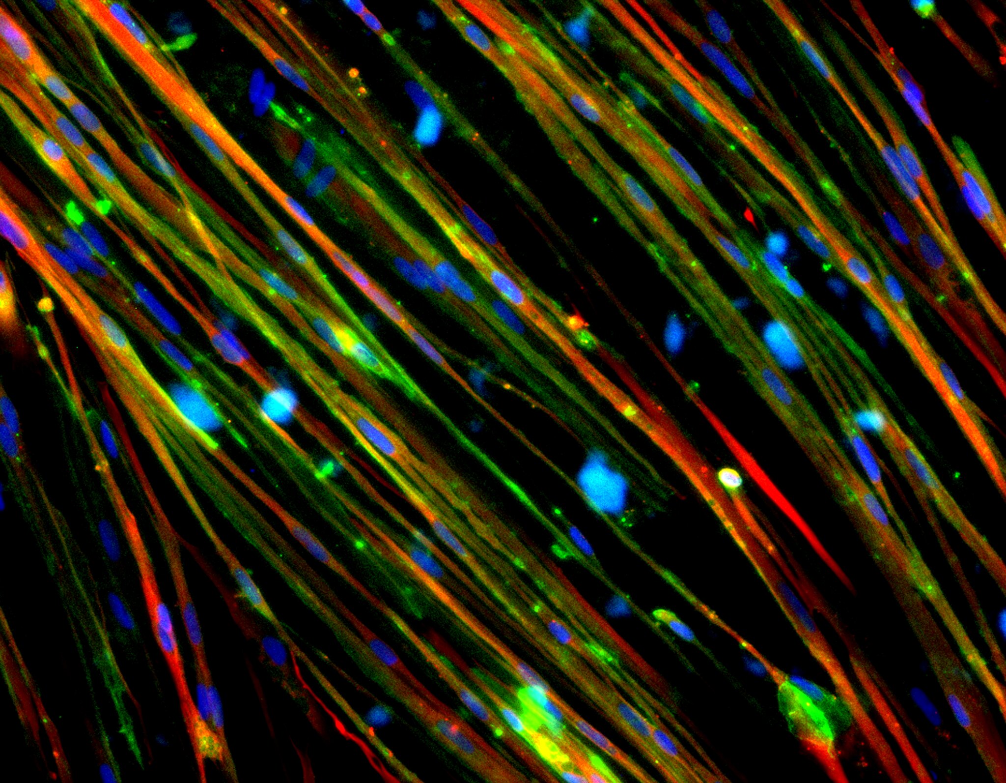 colored lines against black background