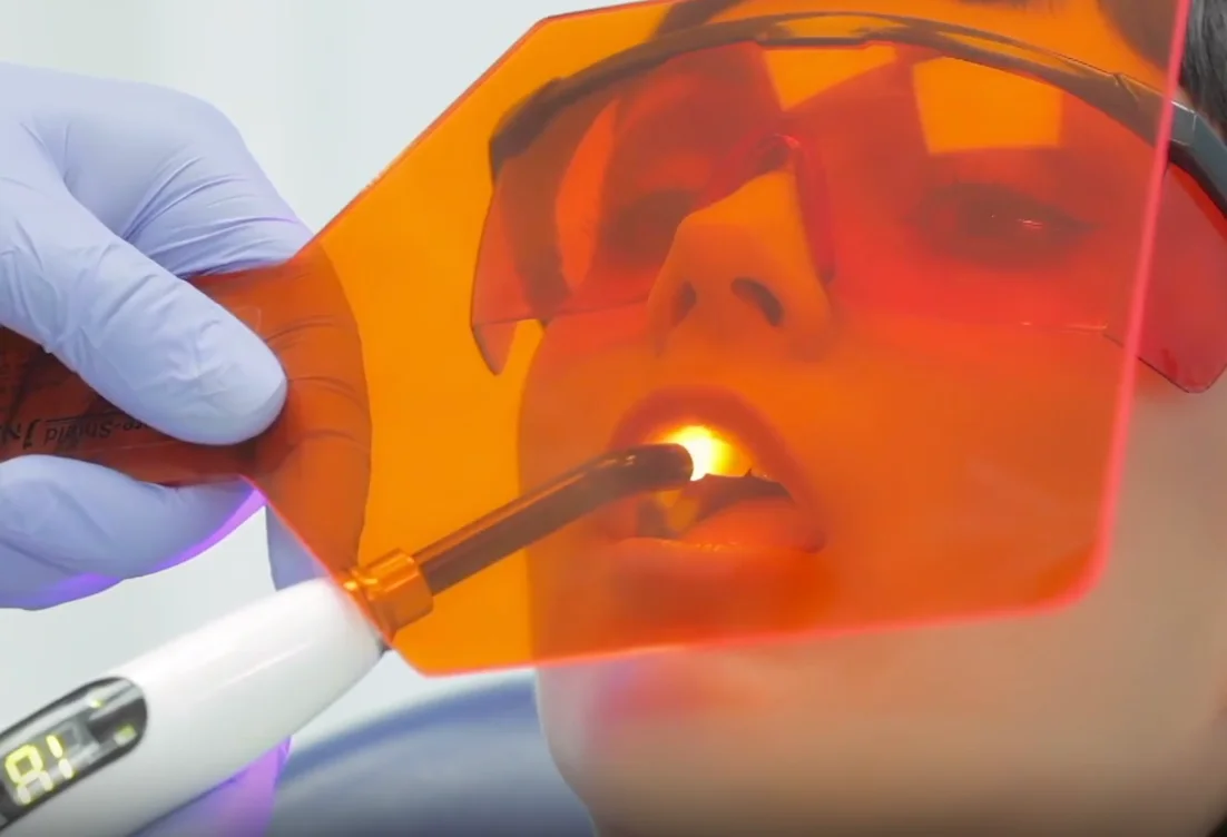 Composite bonding treatment information