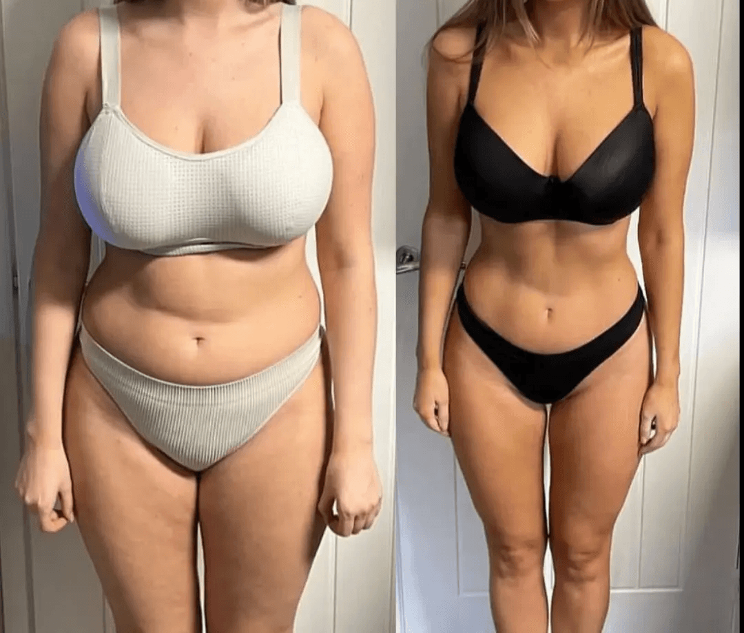 Transformation Photo