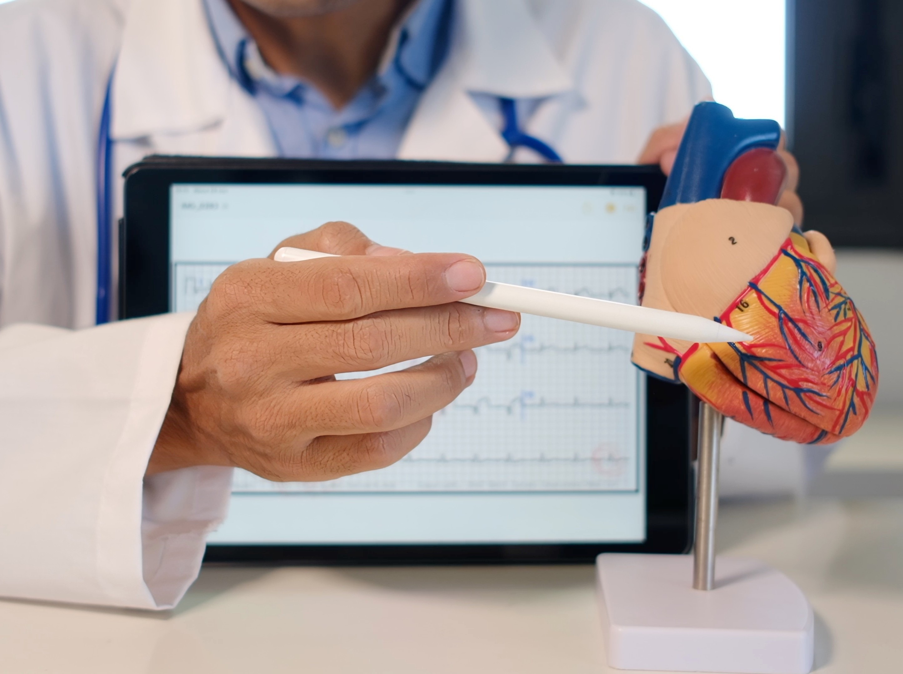 doctor using an anatomy model to explain heart condition effects of taking effective weight loss pills