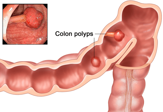 A diagram of a colon
Description automatically generated