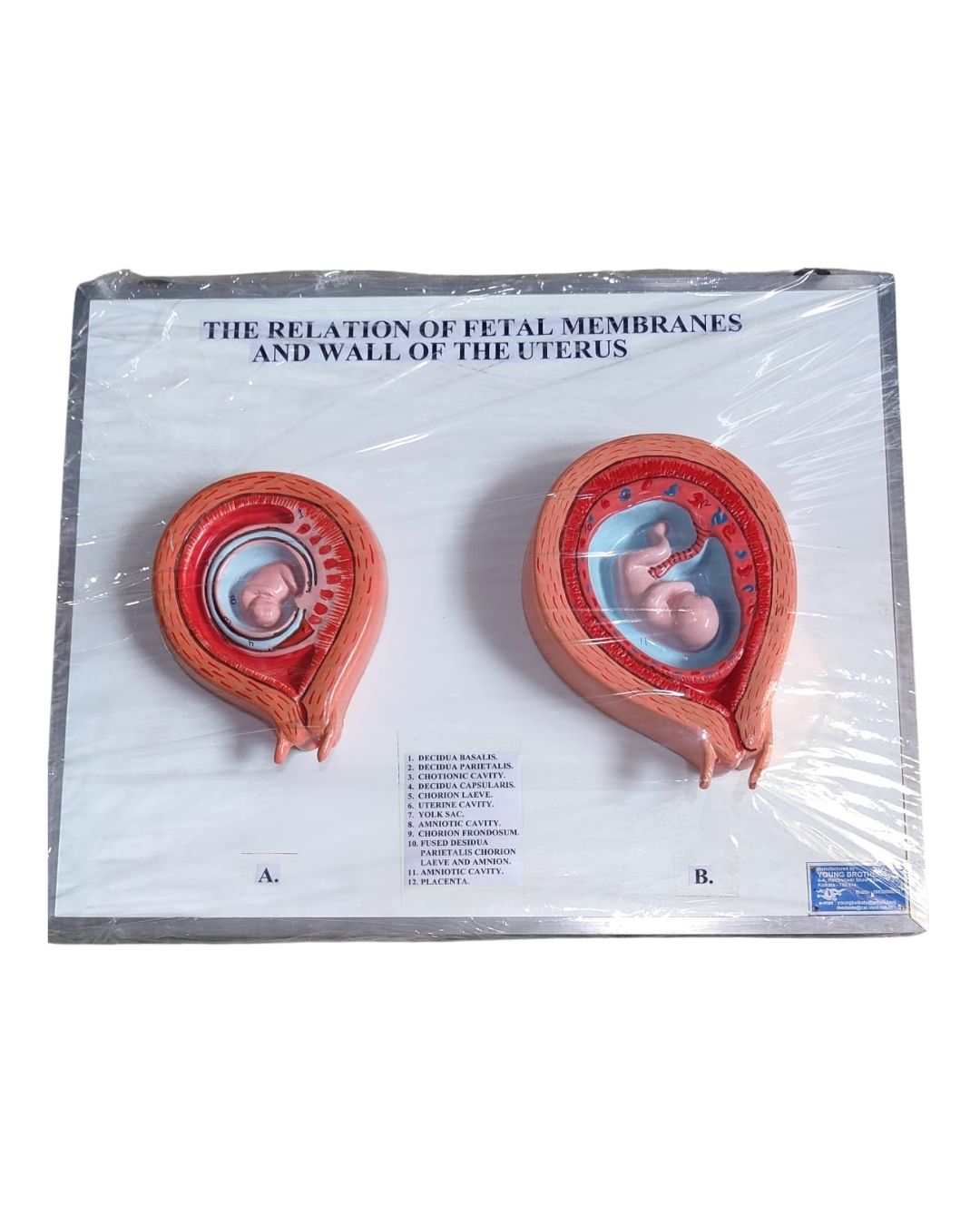 The Relation of Fetal Membranes and Wall of the Uterus