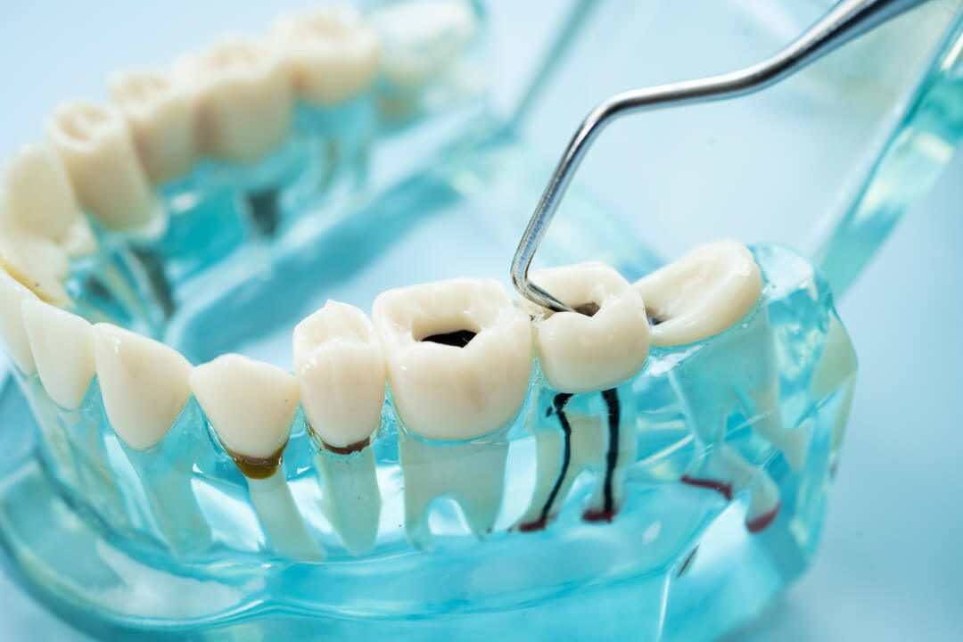 Sobre a especialidade de Dentisteria