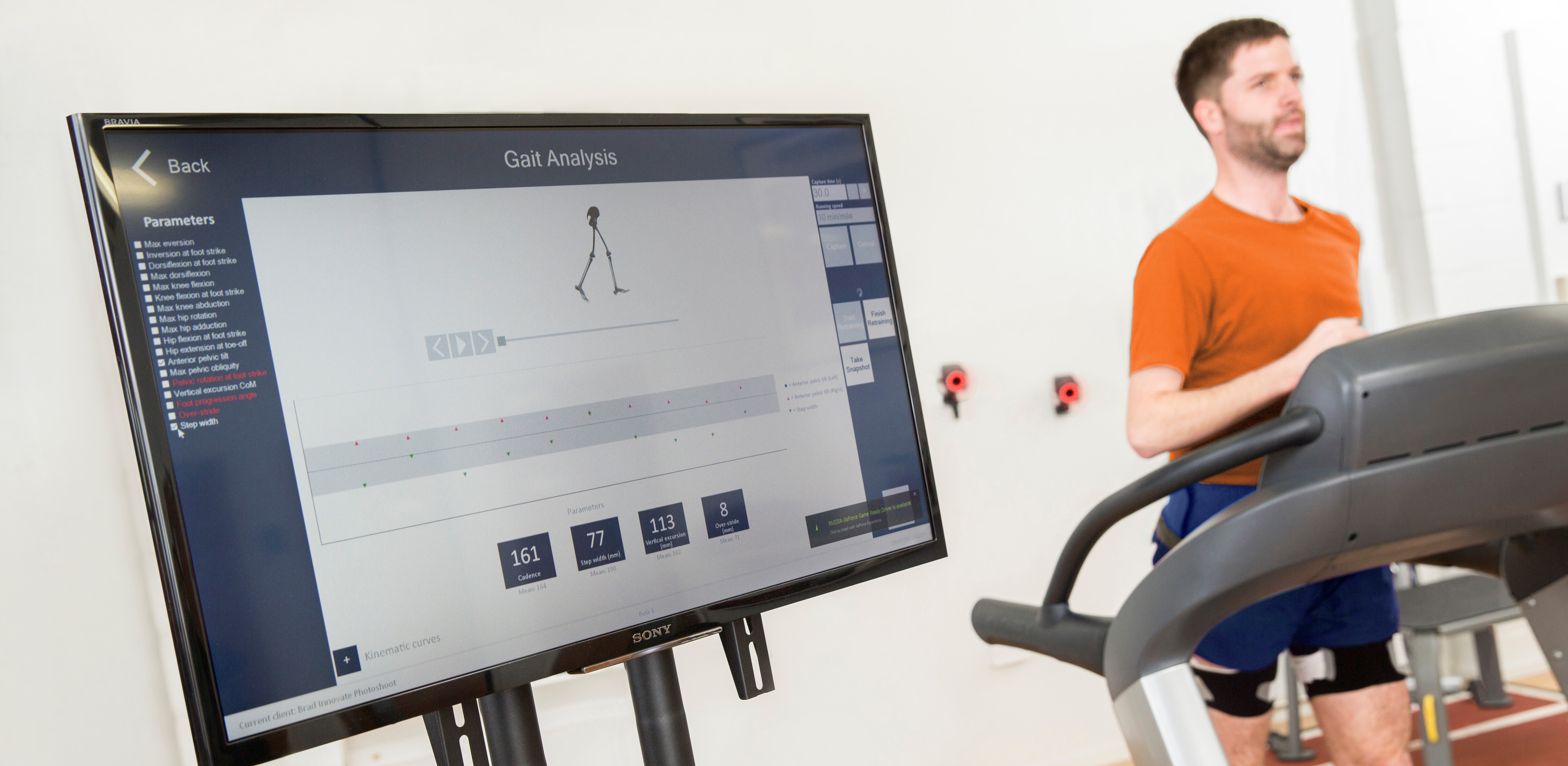 gait testing on a treadmill