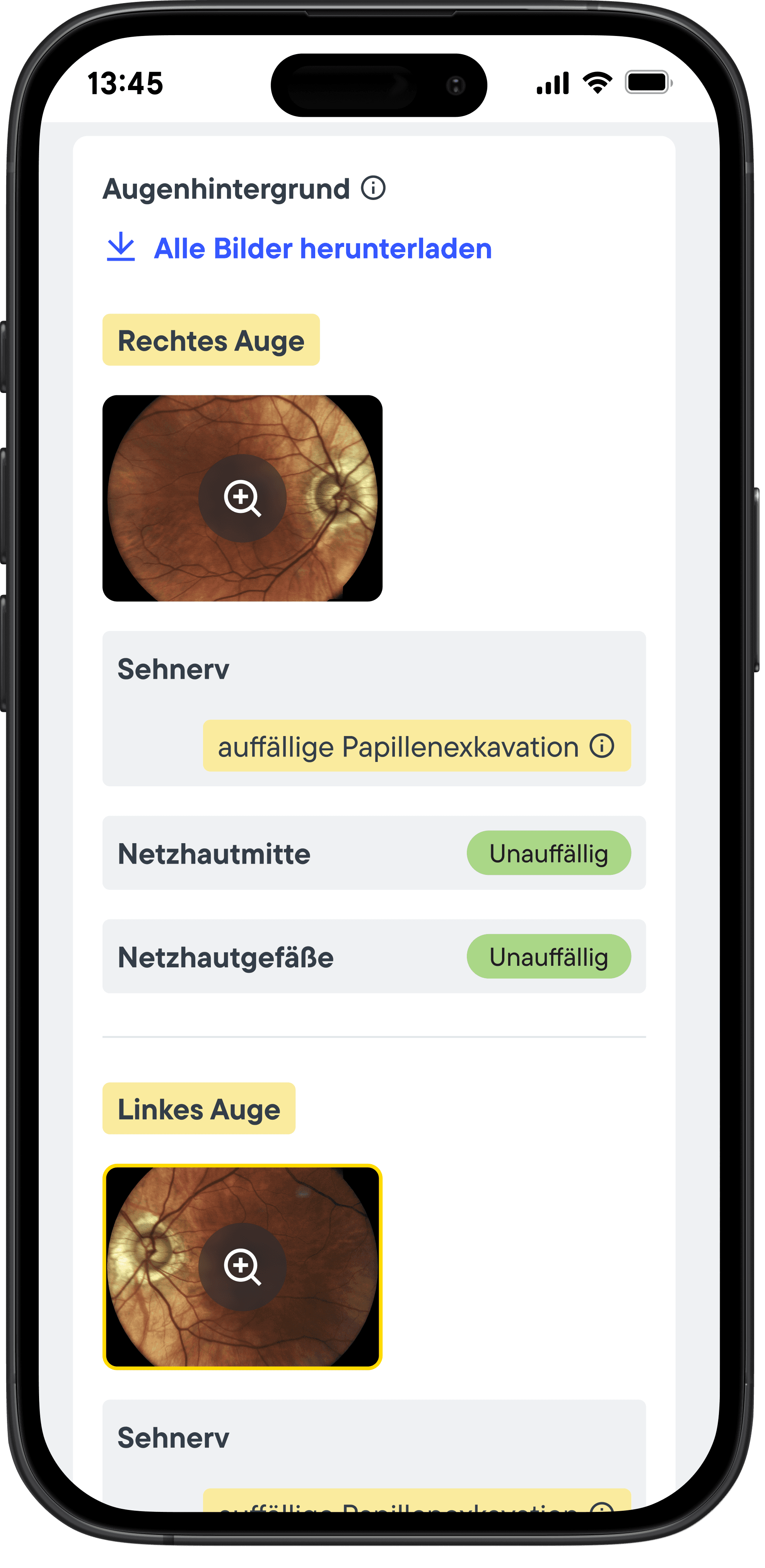 Yellow Ocumeda Report Detail