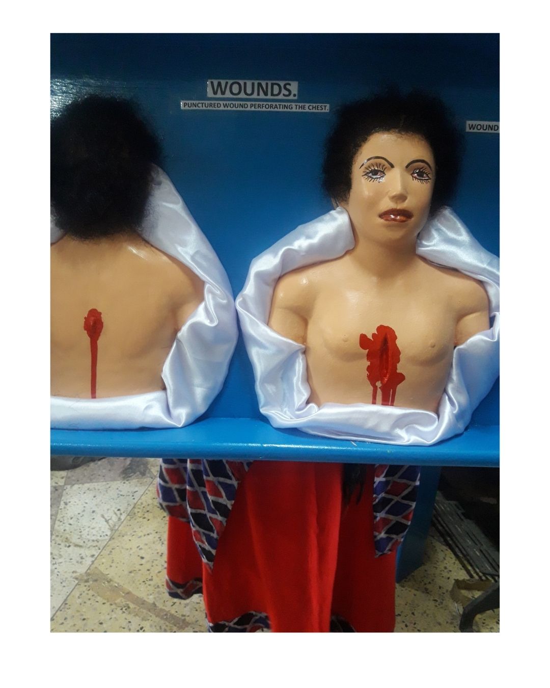 Punctured Wound Perforating the Chest