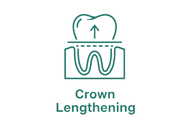 Crown Lengthening Icon