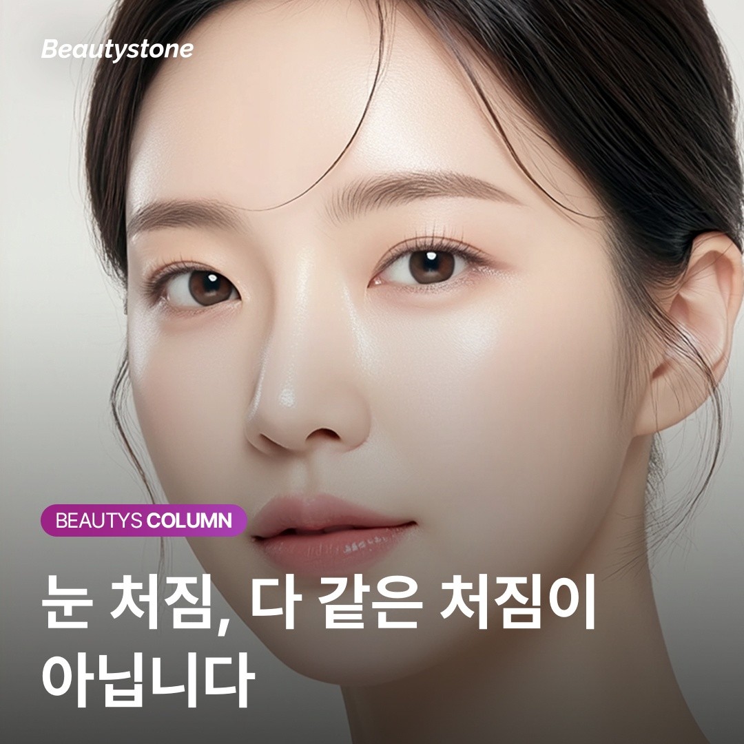 미간 보톡스 후 눈꺼풀이 무거워졌다면? 위영진 원장이 제안하는 유형별 진단법