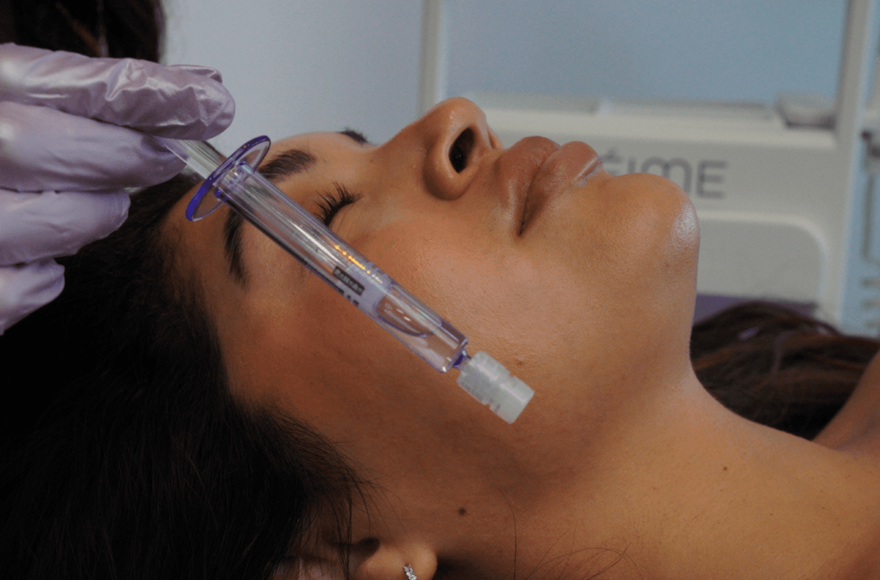 to pair with dermaplaning