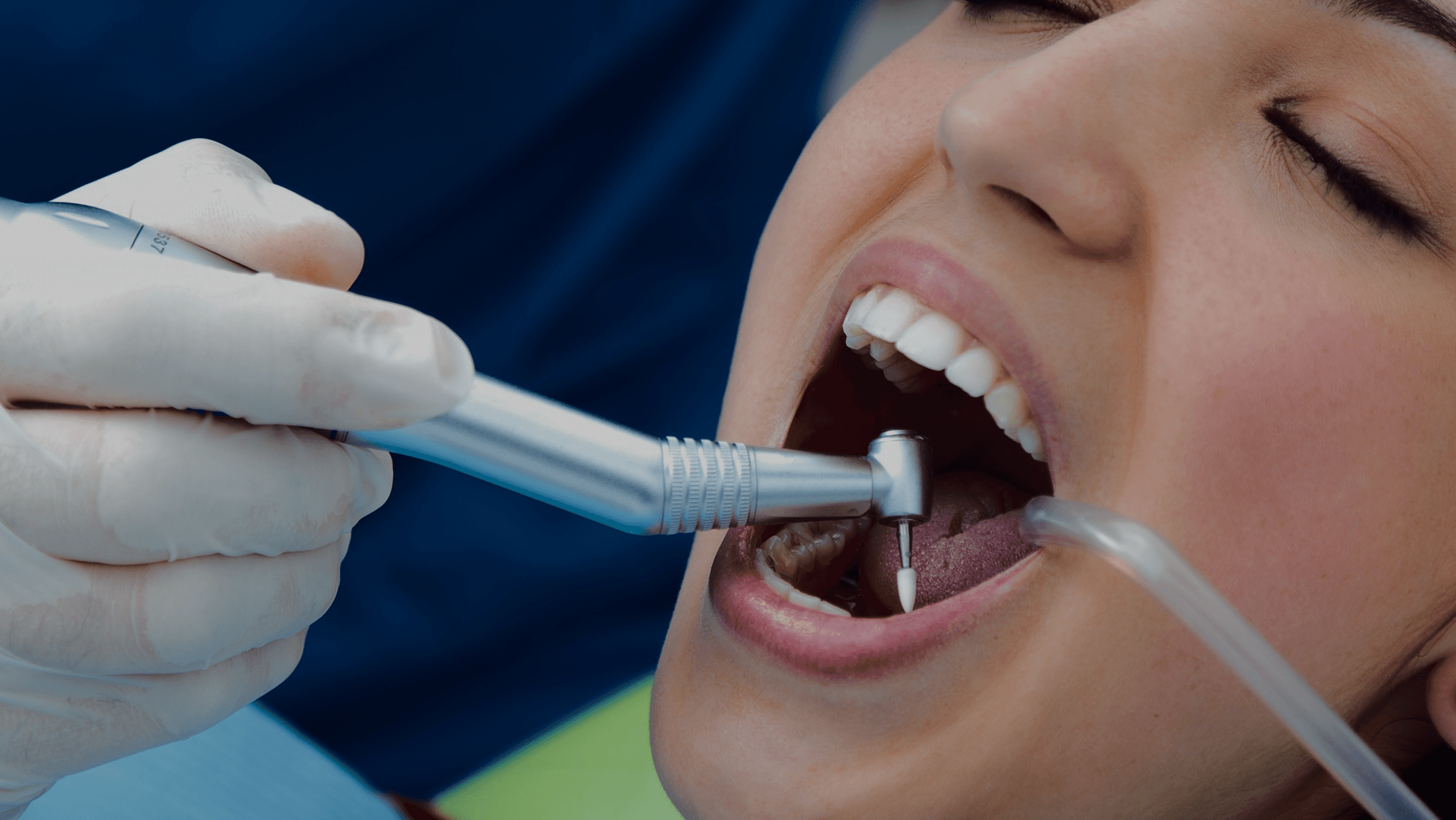 Root Canal Treatment