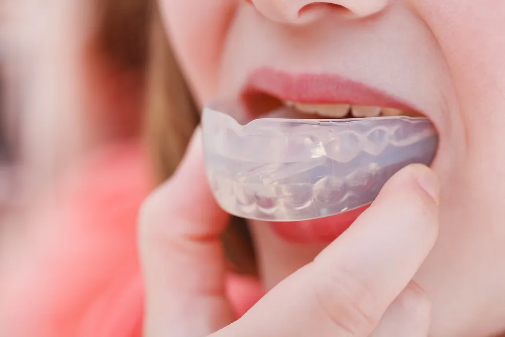 mouthguards in Smyrna
