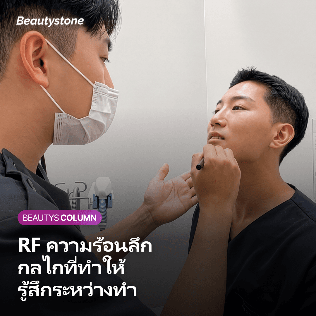 InMode FX คืออะไร และทำไมถึงรู้สึกร้อนระหว่างทำ