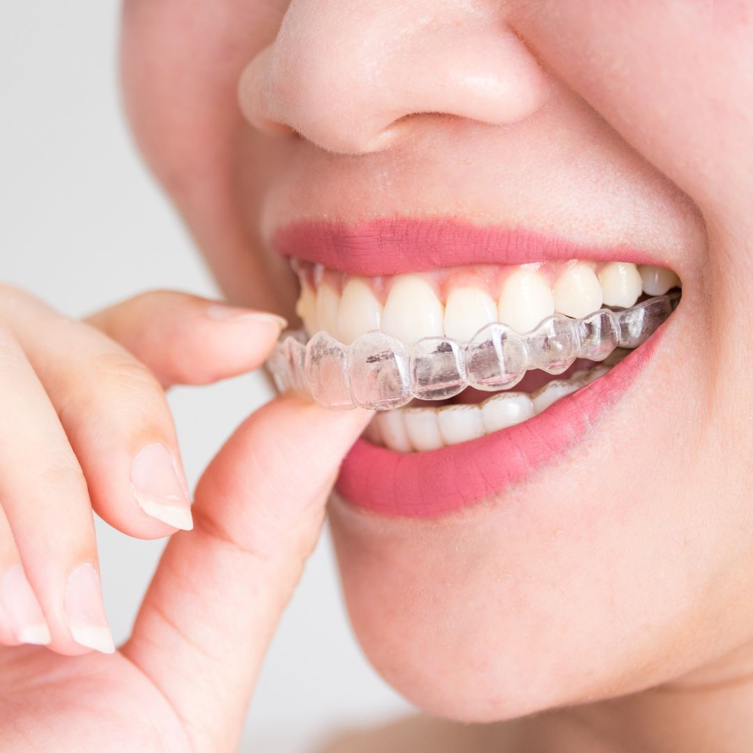 Teeth Checkup