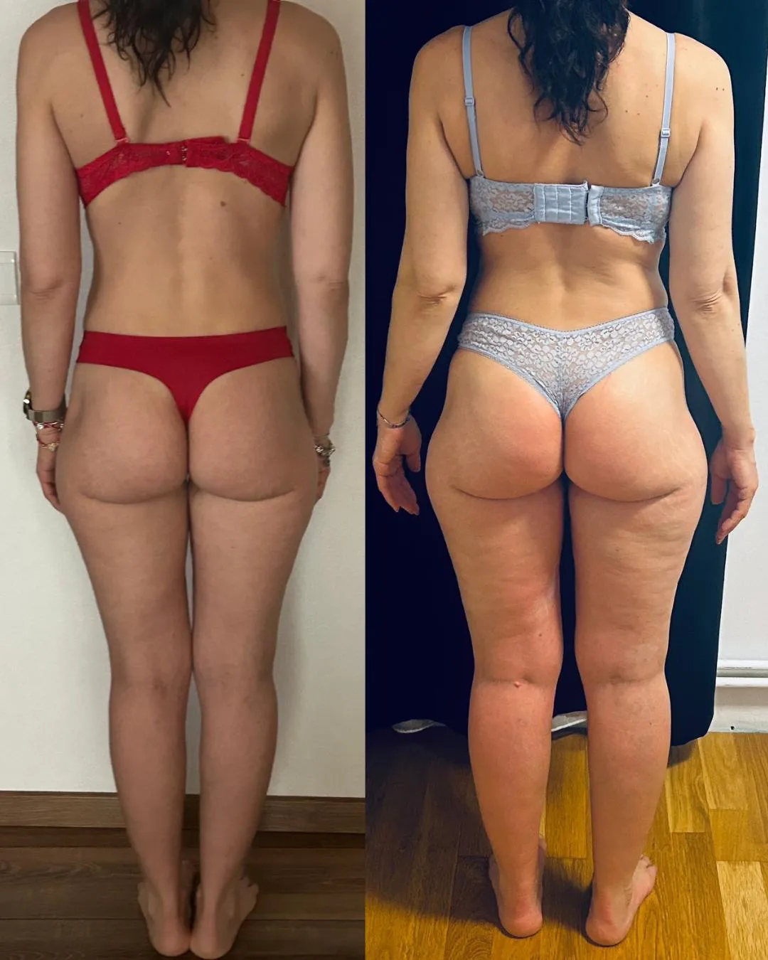 Transformation Photo