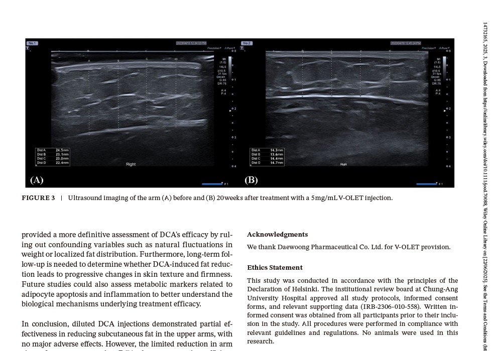 fat thickness ultrasound