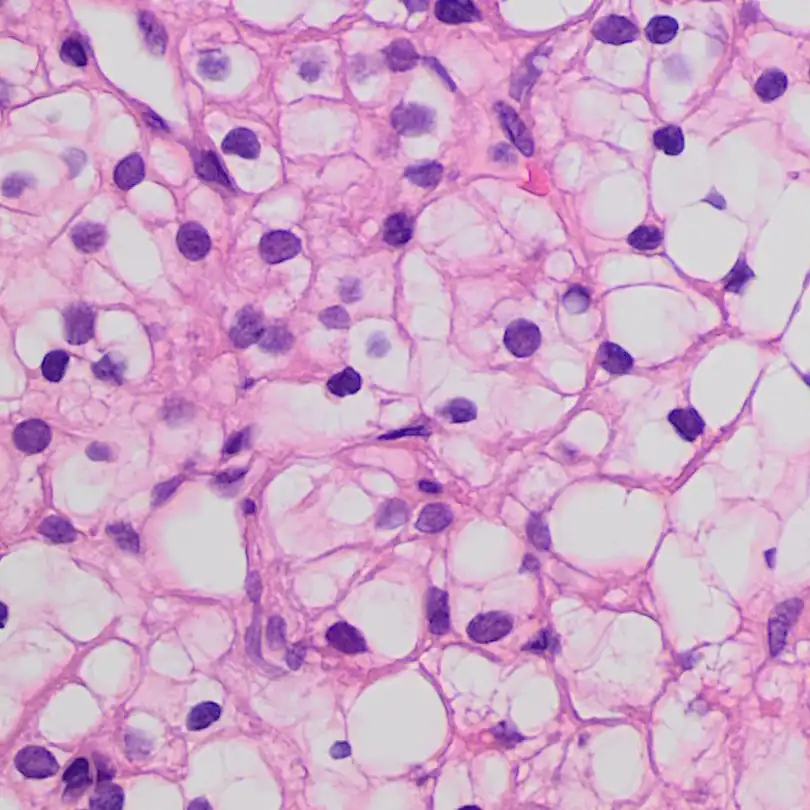 kidney