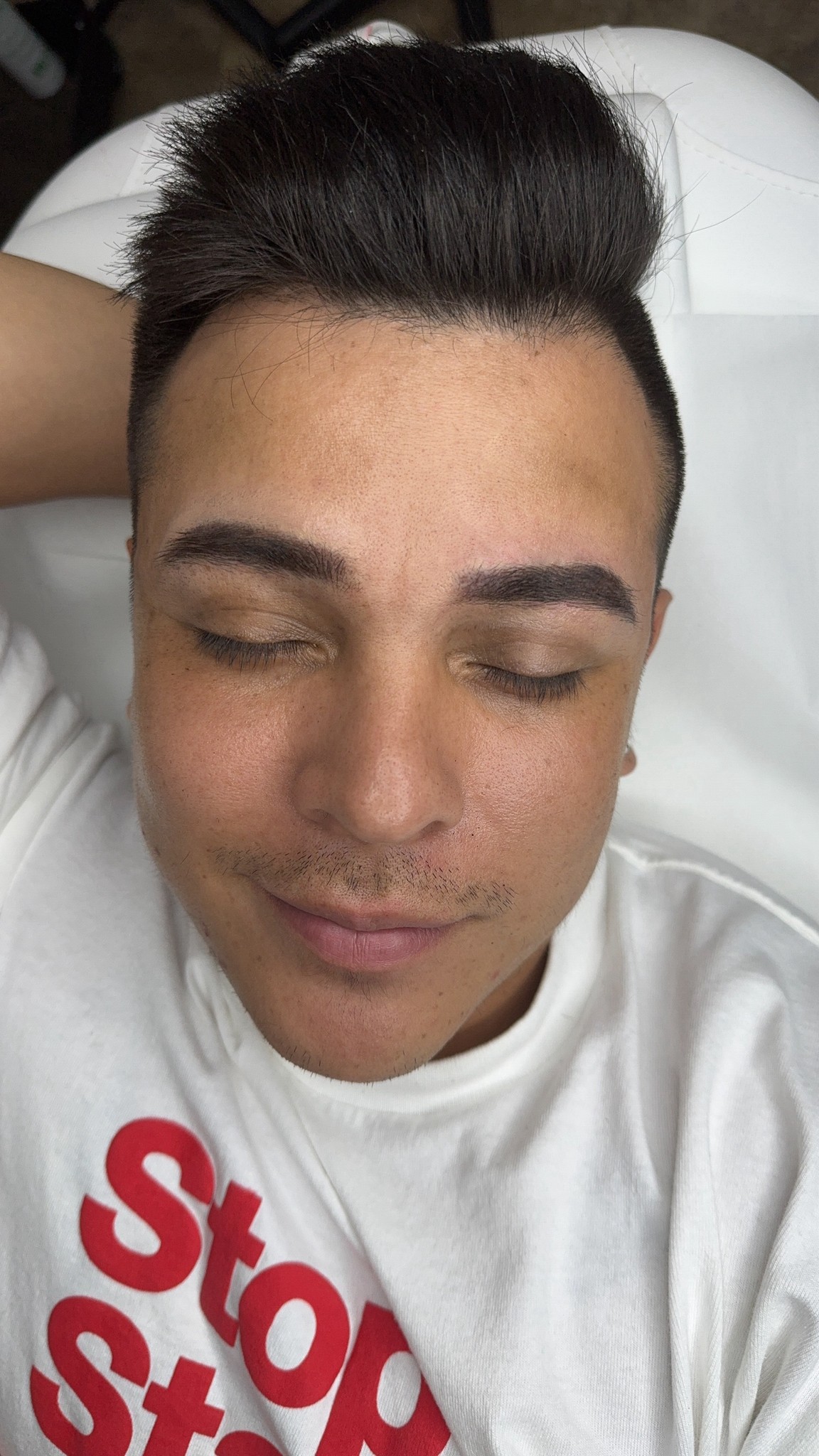 Male face, after the procedure