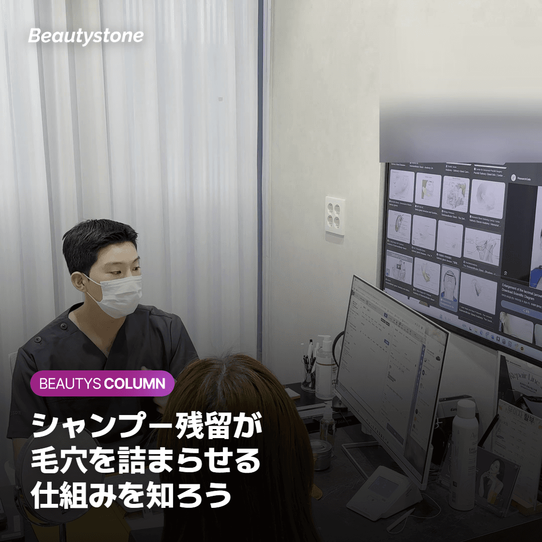 ヘアライン沿いにニキビが繰り返す原因