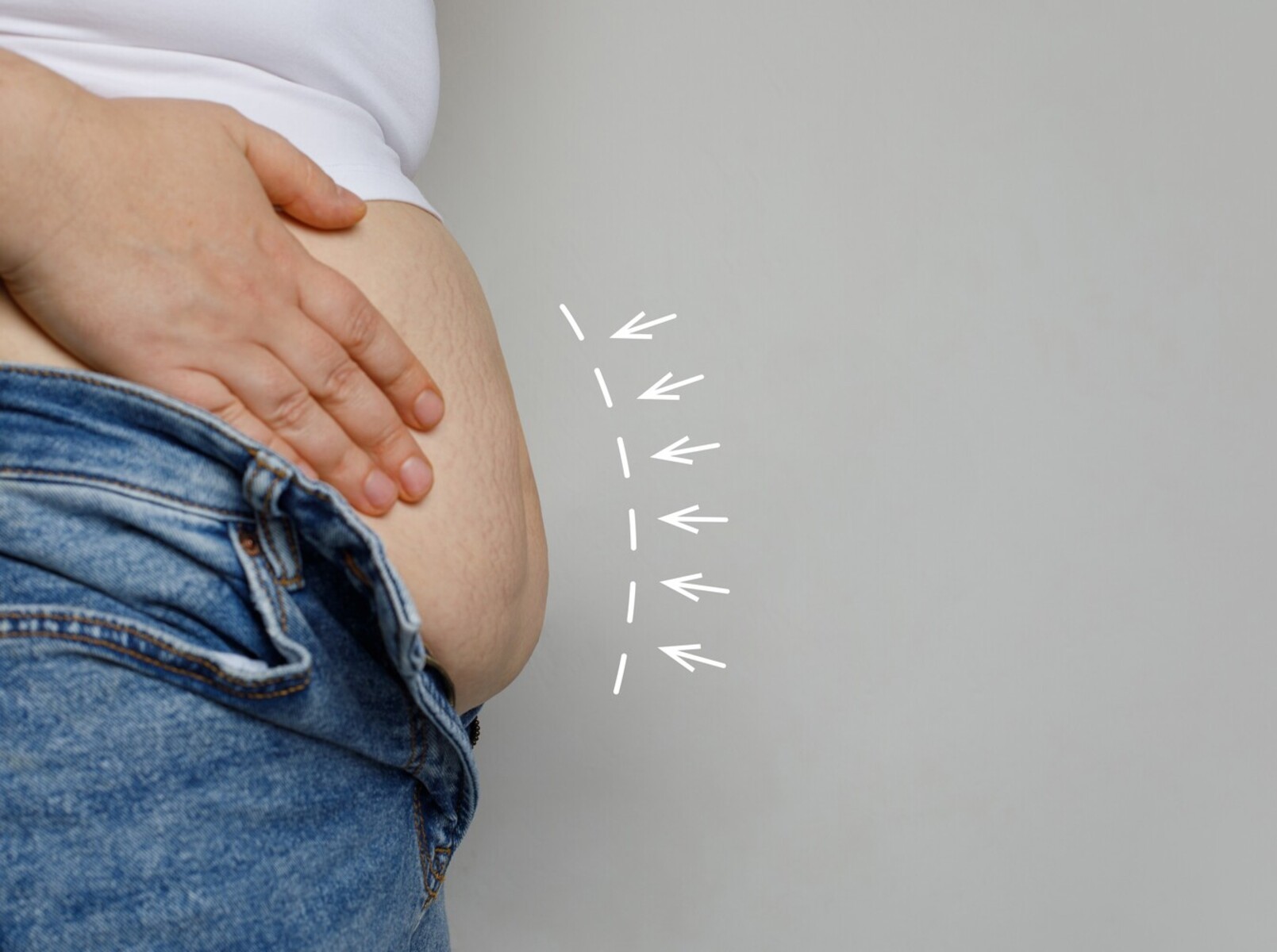 bariatric weight loss