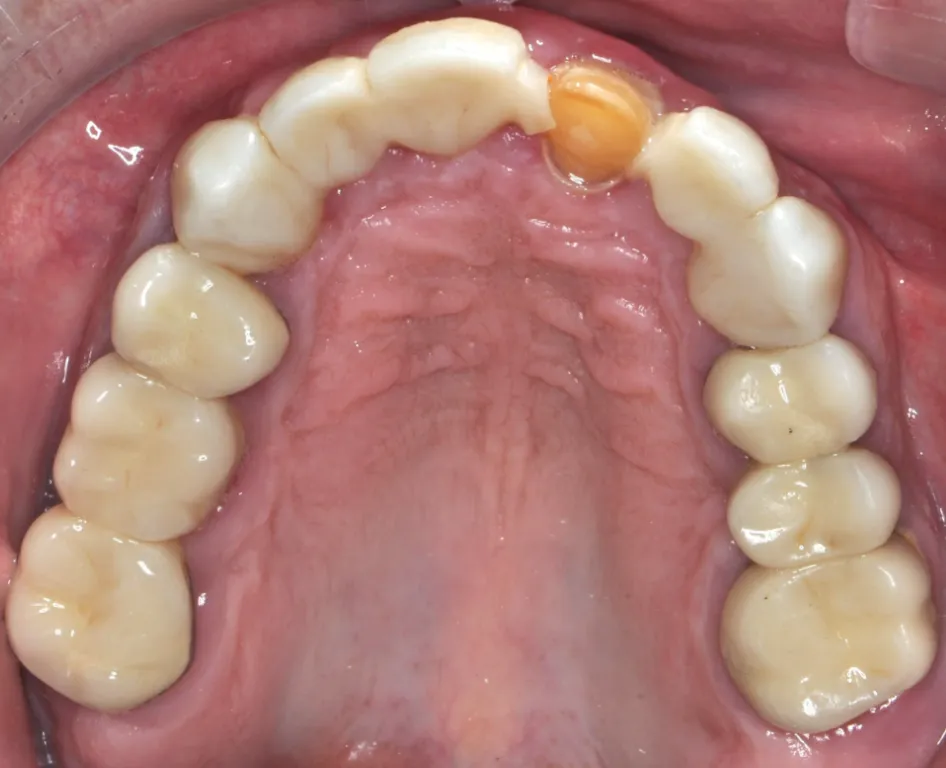 &nbsp;&nbsp;Before ortho treatment
