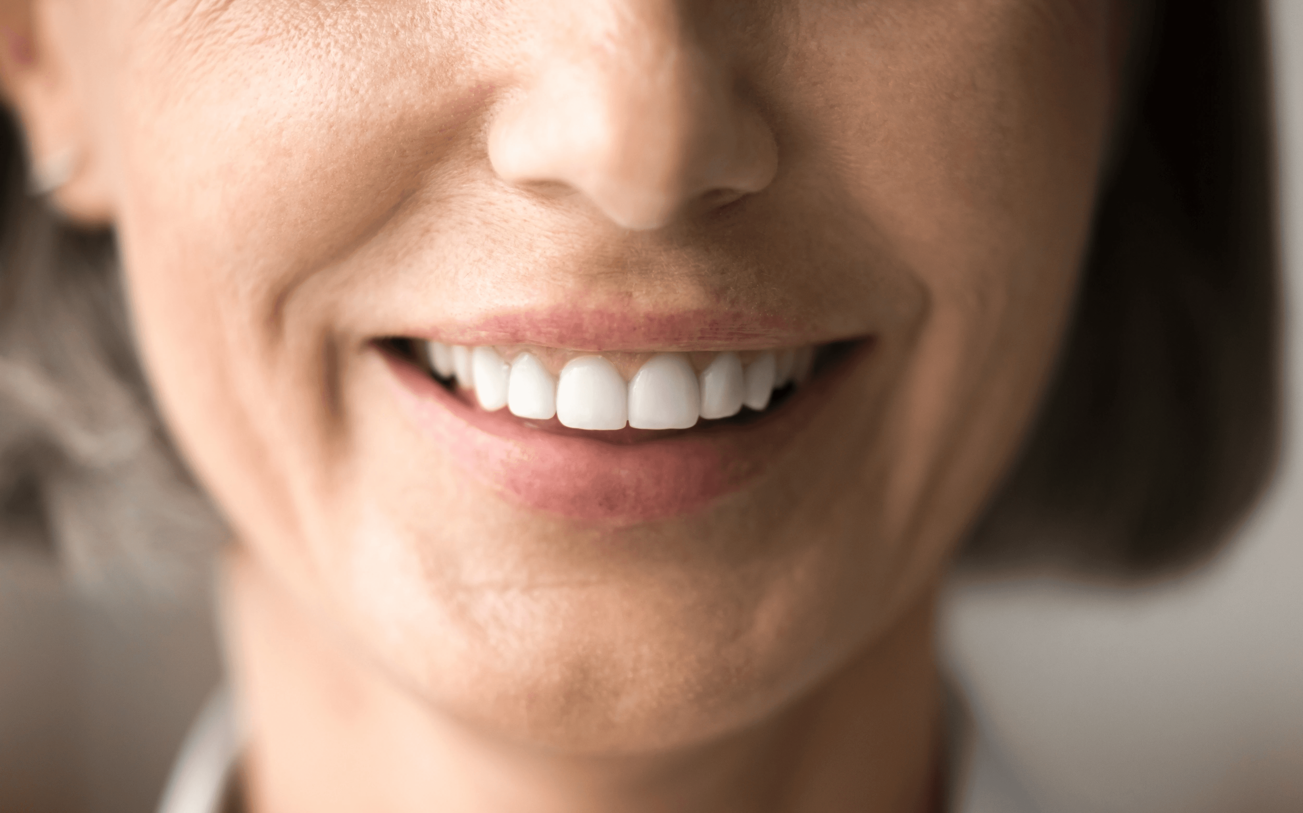 healthy smile after dental implant surgery at invisalign center