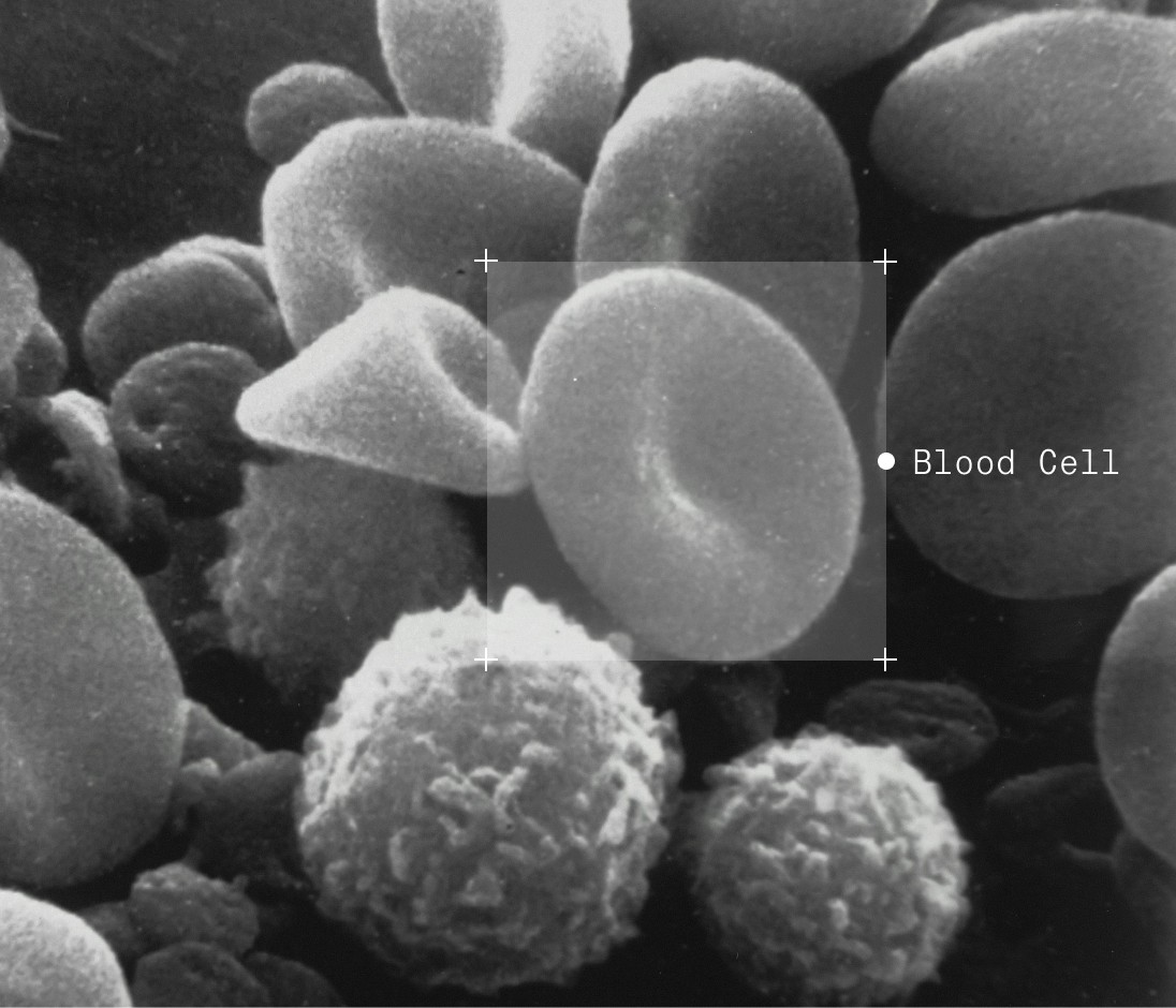 Annotated blood cells