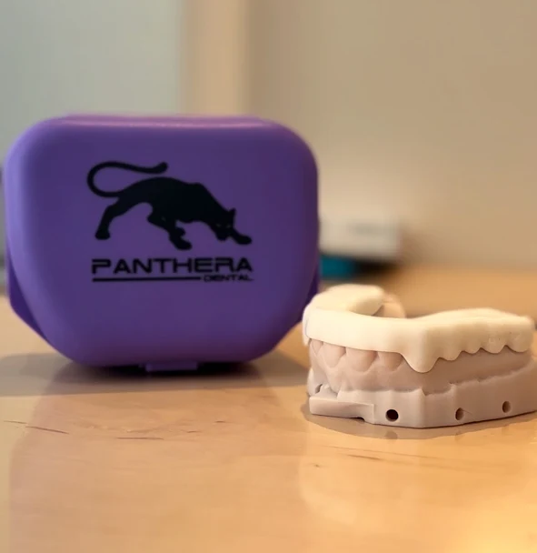 A photograph of Panthera custom night guard at Midtown Dental Studio on Eglinton in Midtown Toronto, Ontario