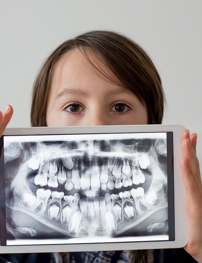 Child holding up digital x-ray of her teeth