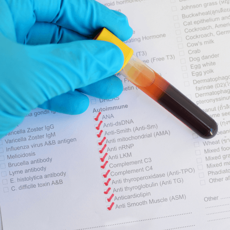 3PmazlGkTprBSZiAxyriX7gZsNI