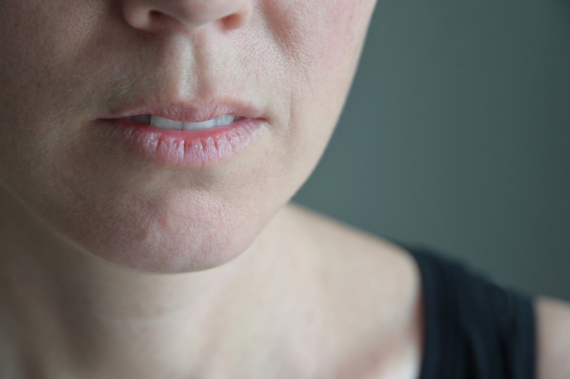 woman looking worried - Does Tirzepatide Cause Dry Mouth