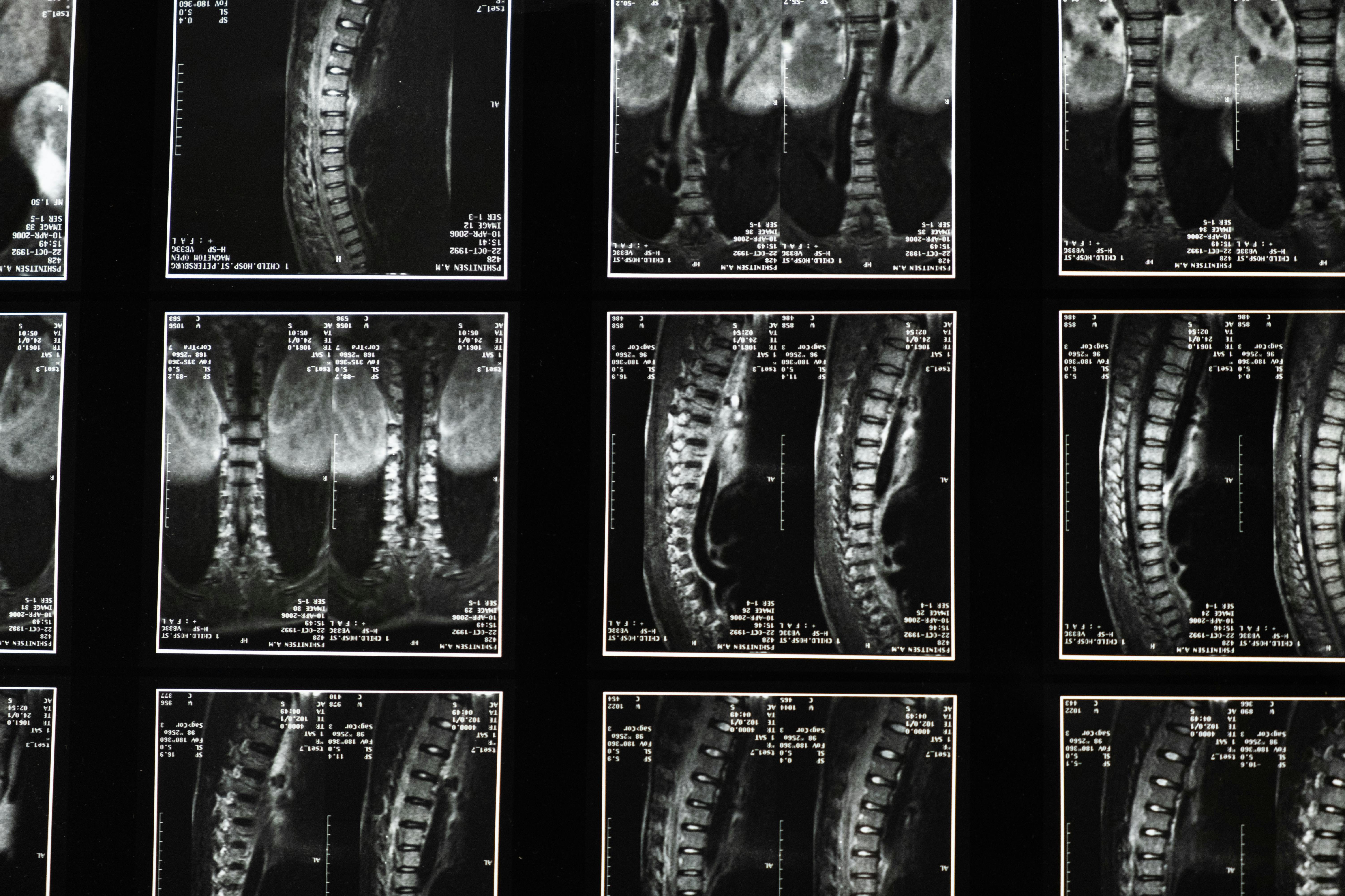 Spinal images