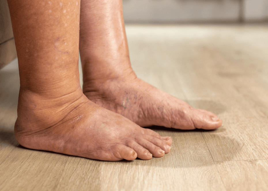 Recovery Monitoring FHIR