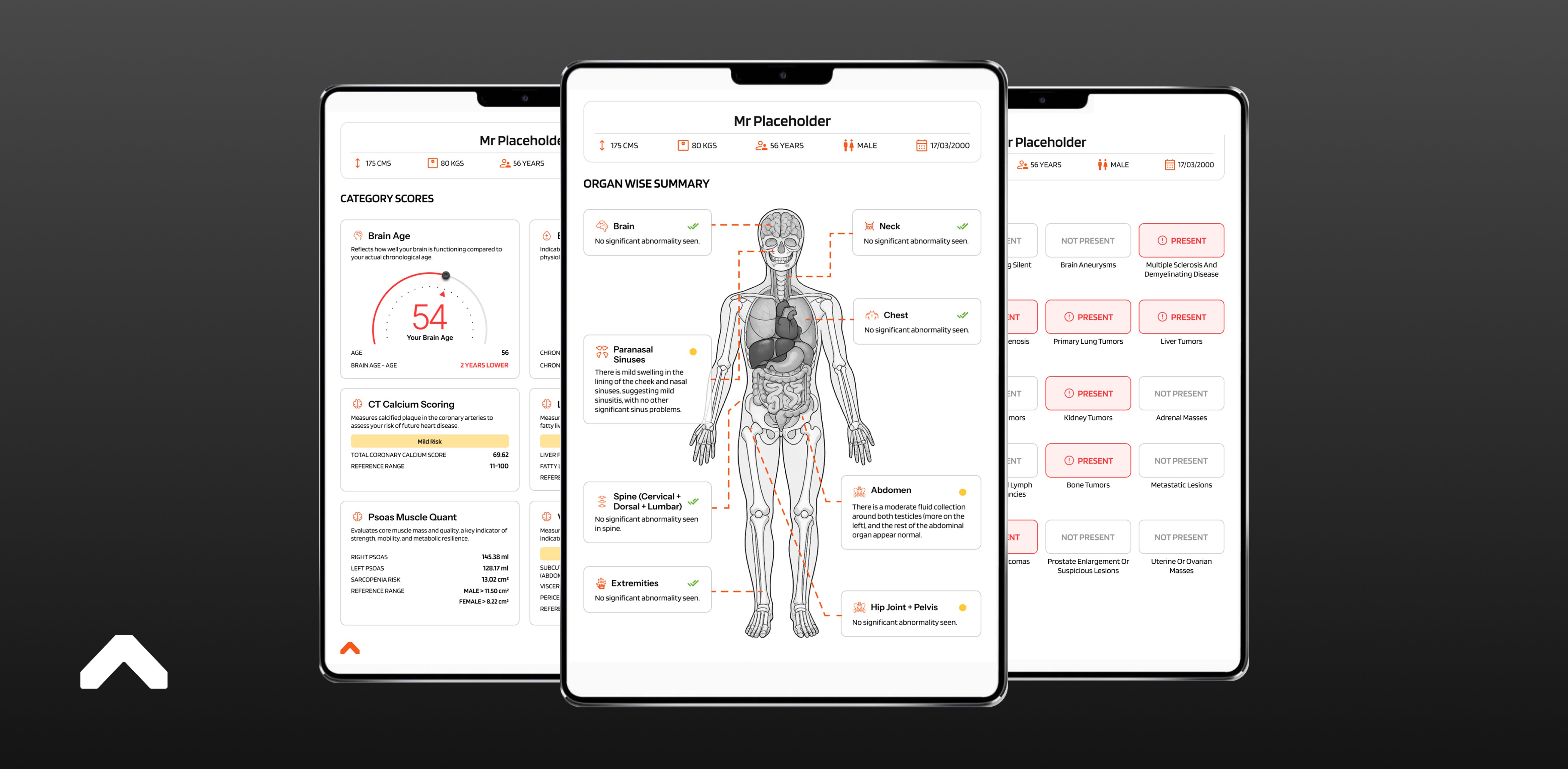 a gloved hand holding a test tube filled with liquid