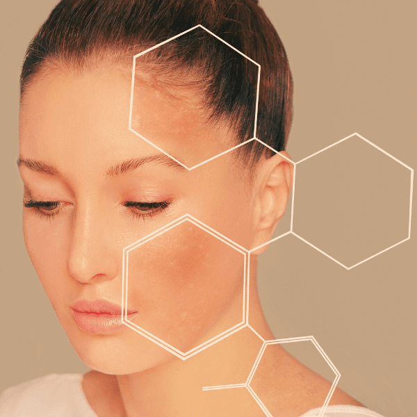 Close up of woman looking down with cell shaped magnifyers showing before image of skin over the after photo