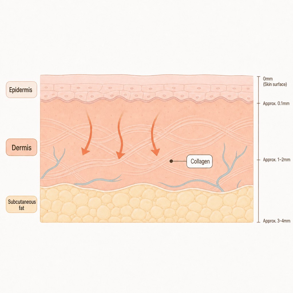 First, let's look at why Onda lifting is not a one-time treatment
