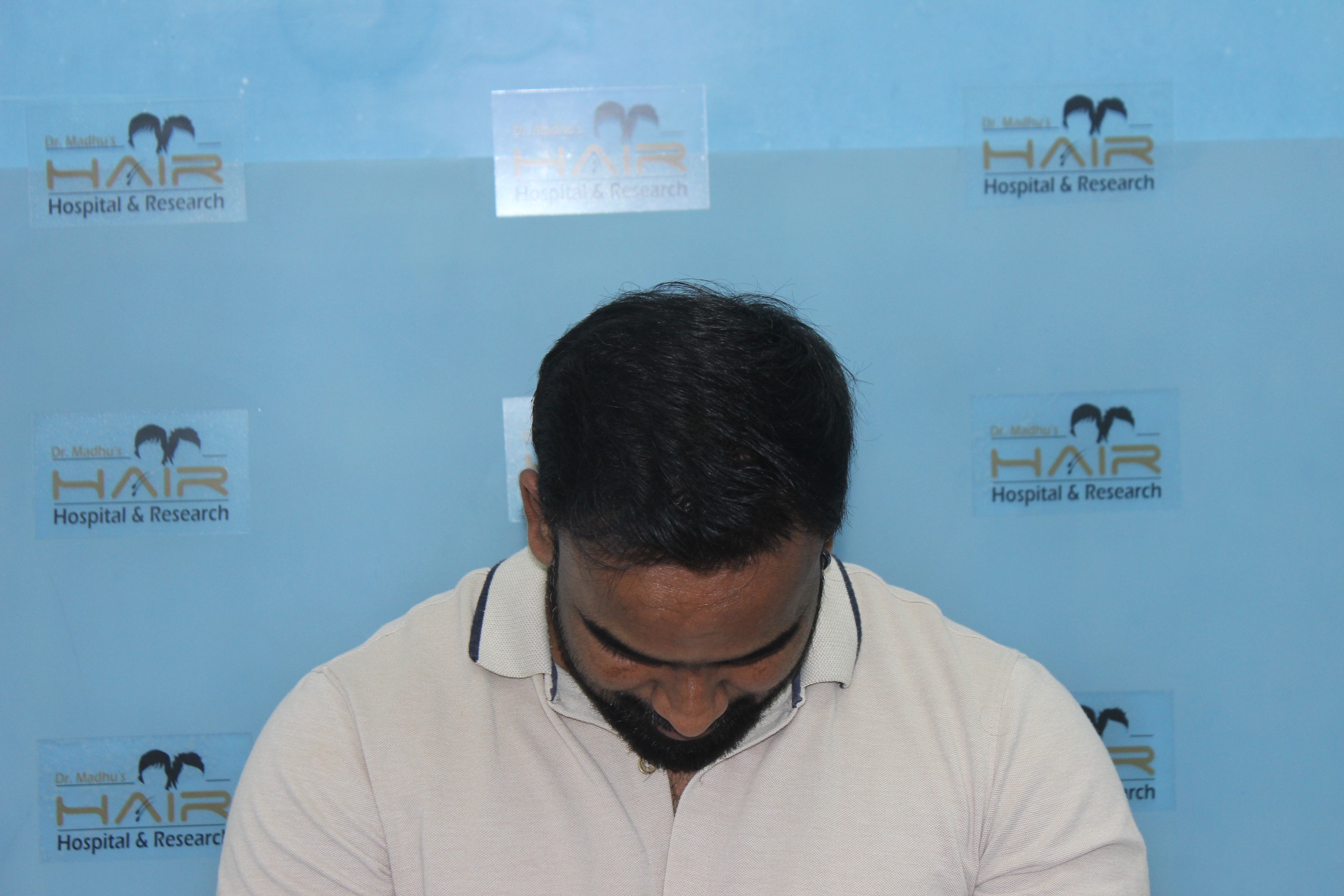 closeup photo of woman wearing black framed eyeglasses