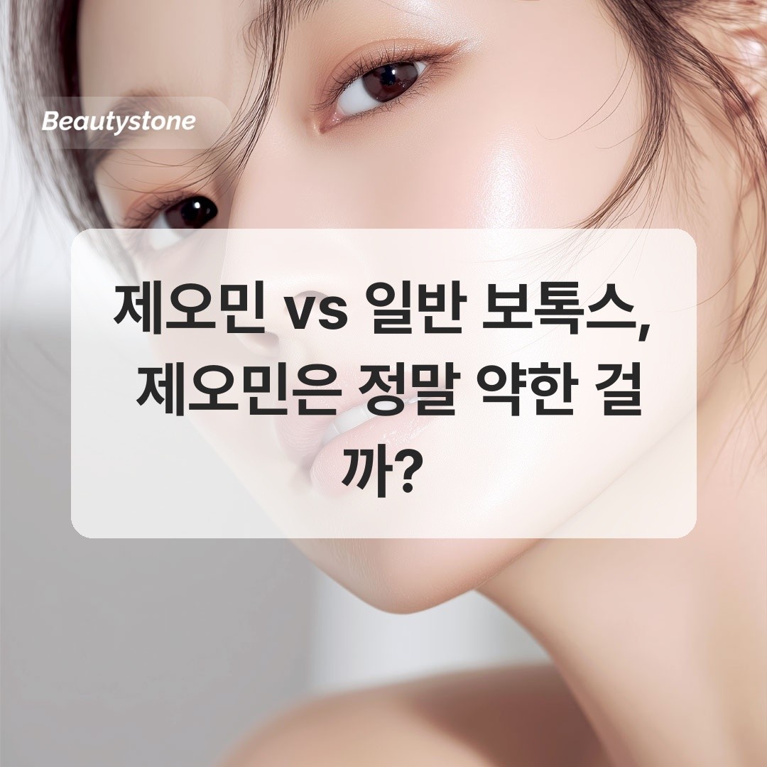 제오민과 일반 보톡스 효과 비교 설명 이미지