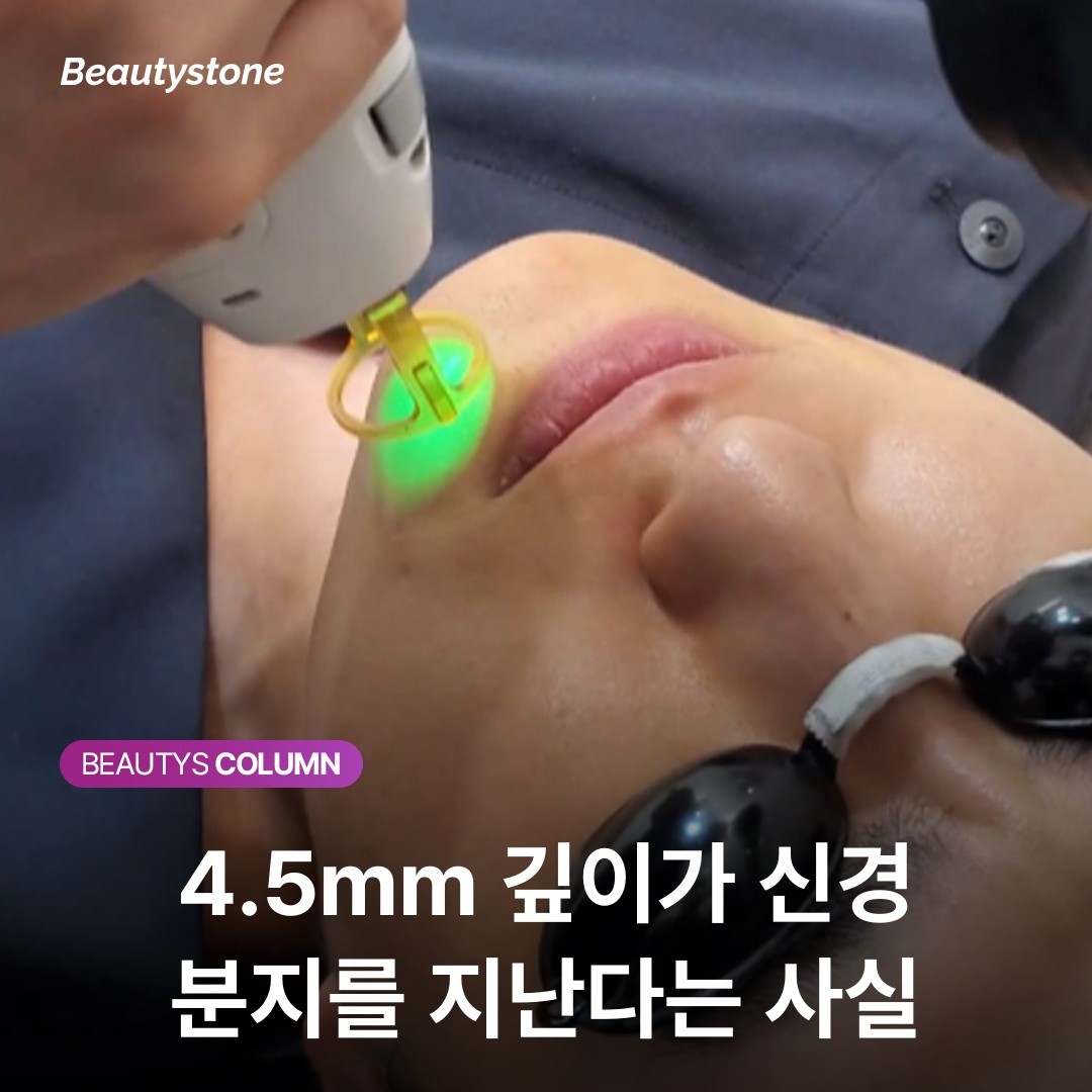멍보다 무서운 울쎄라 비대칭? 4.5mm 신경 구간의 '골든 라인'을 사수하세요