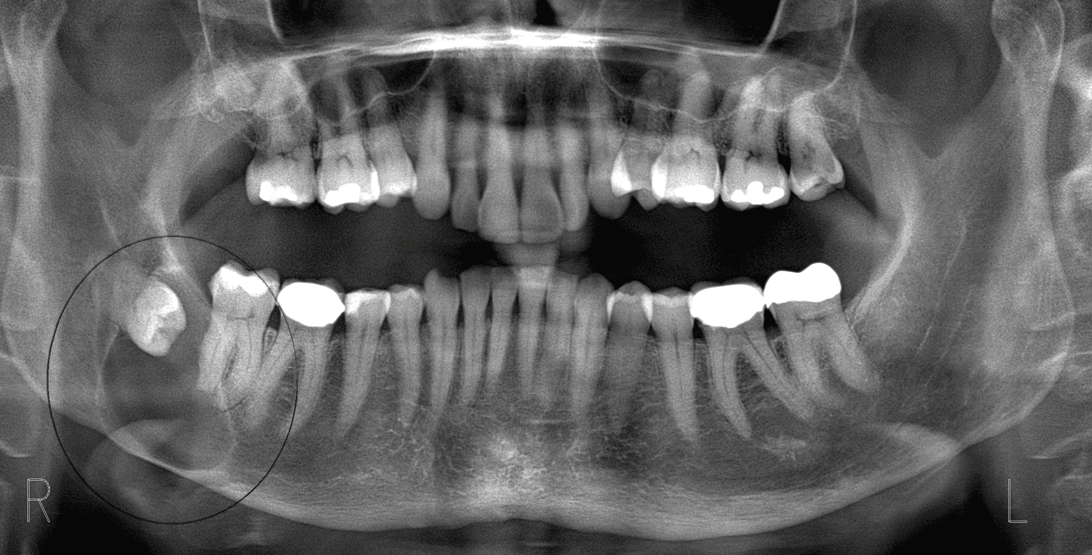 smiling happily caregiver hugging her old