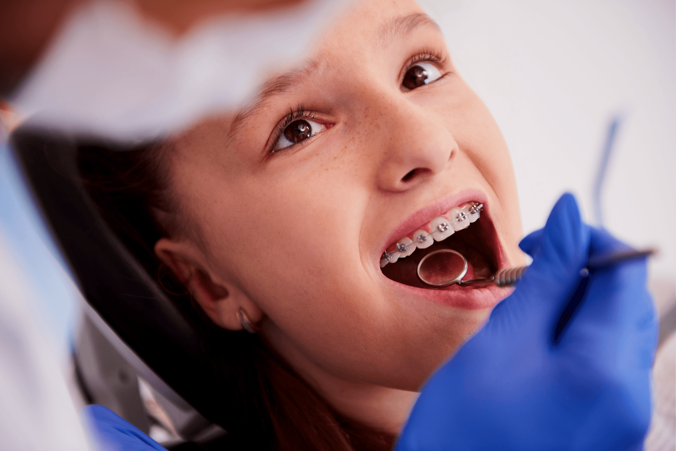 person with silver teeth braces
