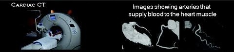 Cardiac CT