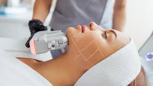 HIFU® en Terrassa, Heaven Clinics