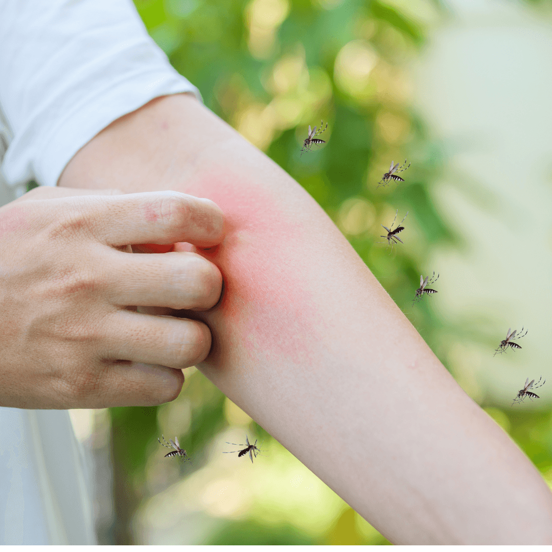 mosquitos biting a persons arm