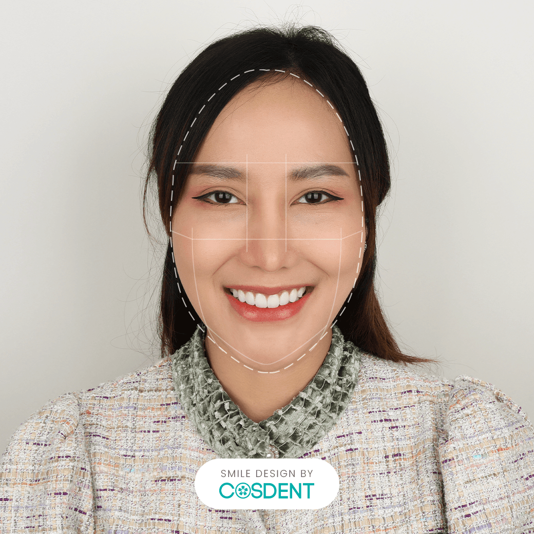 หน้ายาว ยิ้มกว้าง 16 ซี่